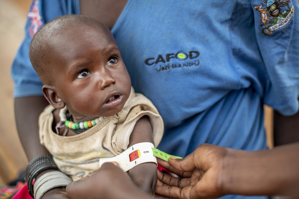 北東部モロトの外来治療センターで、上腕計測メジャーを使った栄養検査を受ける1歳のアコルちゃん。「赤」が示され、重度の栄養不良と診断された。(ウガンダ、2022年5月撮影)