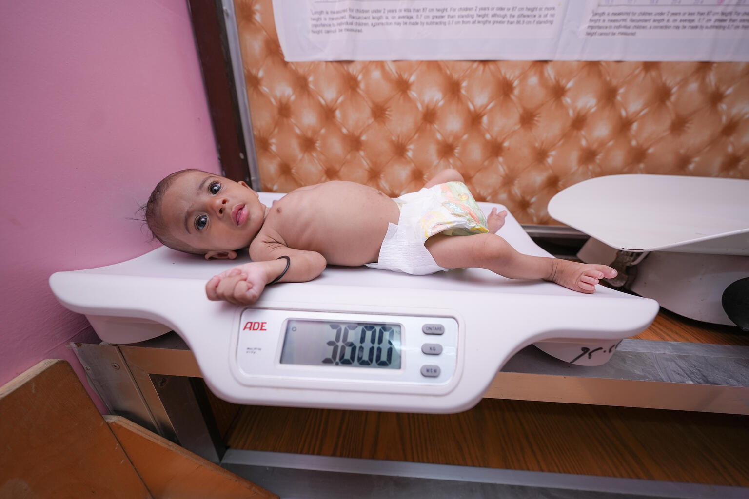イブン・ハルドゥーン病院の栄養治療センターで、体重を測定する生後4カ月のサナドちゃん（イエメン、2023年3月7日撮影）