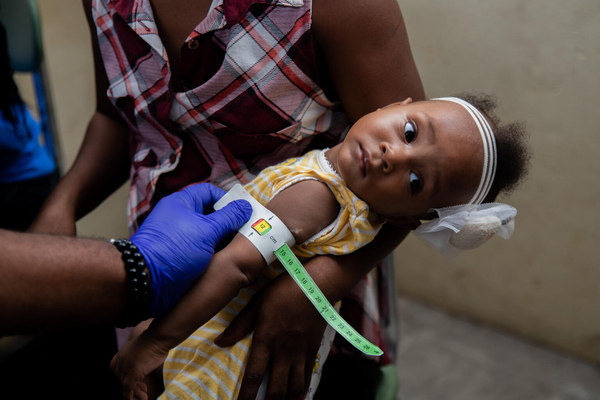 ユニセフが支援する移動式クリニックで、上腕計測メジャーを使った栄養検査を受ける子ども。(ハイチ、2024年4月撮影)