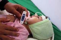 イエメン・サヌアのアル・サビン病院で、診察を受ける1歳のカウラちゃん。生後4カ月の時から治療を受けている。