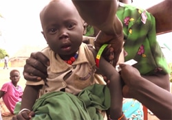 栄養不良の兆候があるか、診断を受けるキエク・クオンで暮らす子ども。（南スーダン）